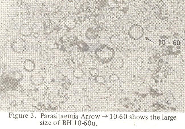 Figures 1,2 and 3 at 400 magnification show mild, moderate and heavy parasitaemia of BH. Figure 2 and 3 show the two sizes of the organism 8-10 and l0-60u.