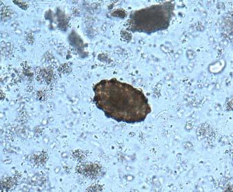 and Cryptosporidium sp., which was negative for both organisms. A modified acid fast stained slide was also negative.
