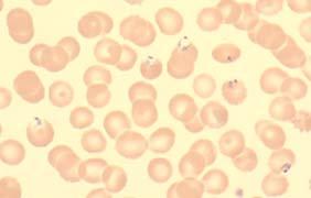 Organism Plasmodium falciparum 89/101 88 10/10 Correct Babesia sp.