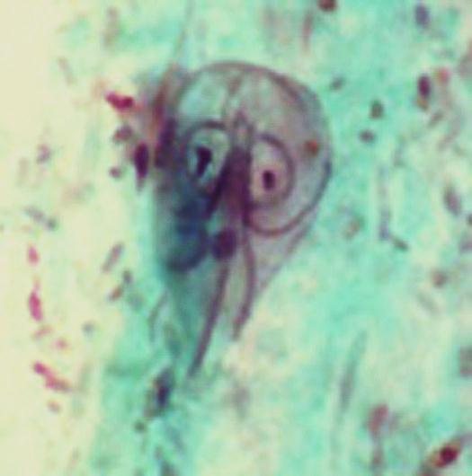 Giardia lamblia (duodenalis,