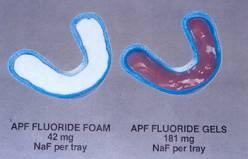 Fluoride Foam/gel Foam advantages Limited ingestion