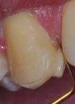 Clinical www.dentistry.co.uk aesthetic changes using only composite resin.
