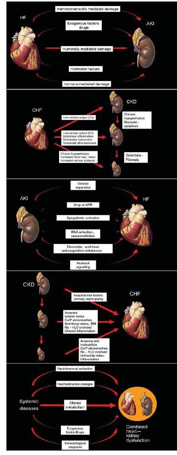 Classification and definitions of cardiorenal syndromes CRS type I (acute CRS): abrupt worsening 