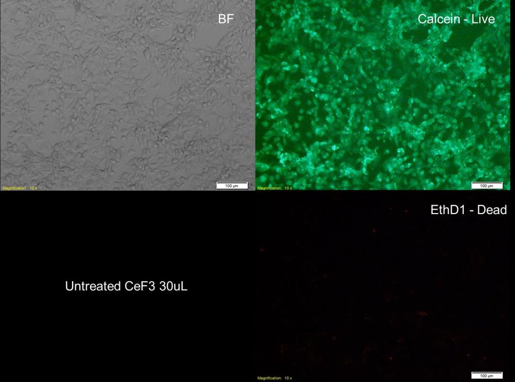 Figure 1. The image on the top left shows the Bright Field image of CeF3 after it was placed in the Prostate cancer Cells.