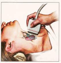 Thyroid nodules: imaging Ultrasound better than palpation and scintigraphy for thyroid nodules and cervical lymph nodes inexpensive, non-invasive provides valuable characteristics of the