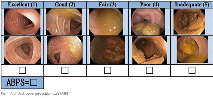 /surveillance When should colonoscopy be repeated if initial prep is poor?