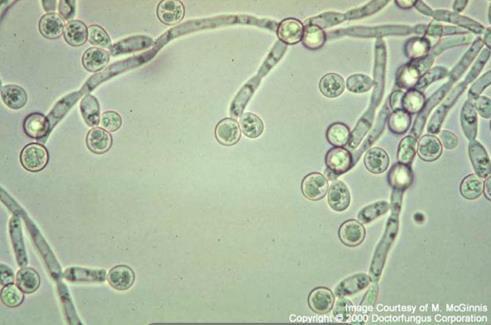 Candida spp. General Characteristics: it is yeast.