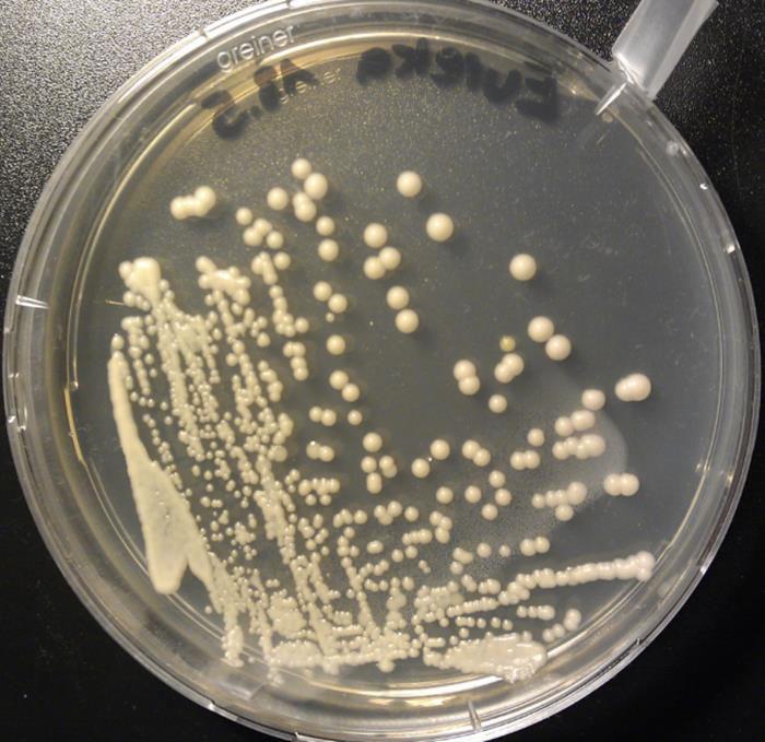 Culture: Most Candida spp.