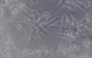 µ/ml. T47D Cells E. n-hexane Chloroform Ethyl Acetate.Ethanol Figure 1. Morphology of T47D cells after incubated some extracts for 24 h (magnification 10 x 10).