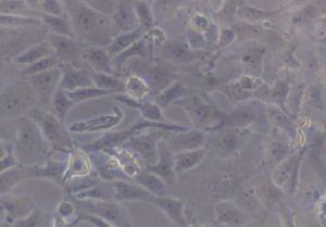 Vero Cells n-hexane Chloroform Ethyl Acetate.Ethanol Gambar 2. Morphology of Vero cells after incubated with all extracts for 24 h (magnification 10 x 10).