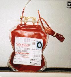 Dissolved in plasma 3% Henry s law volume α partial pressure of that gas of dissolved gas blood 100 ml
