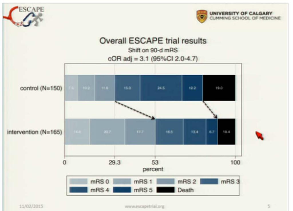 ESCAPE: Randomized Assessment of Rapid Endovascular Treatment
