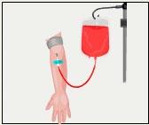 31) Allergic reaction to medications Blood loss requiring transfusion with its low risk of disease