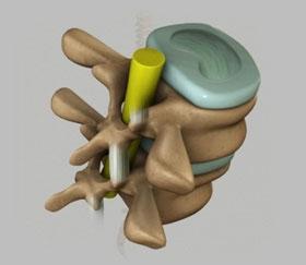 Unit 1: Normal Spine Anatomy (Refer fig. 7) (Fig.