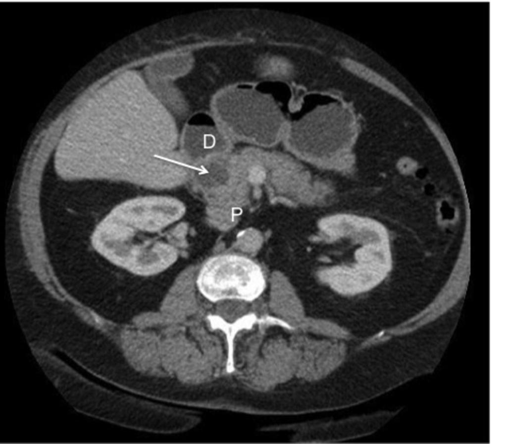 Fig. 6: Axial CT.