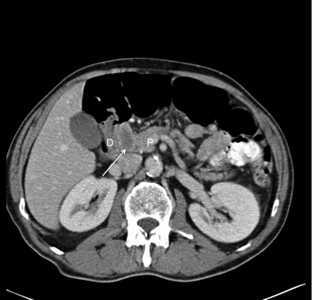 Fig. 10: Axial CT.