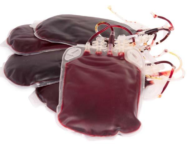 Fresh whole blood: 500 ml Hct 33-43% Plt 130-350,000 Fibrinogen 1500 mg Clotting activity 86% Full platelet activity Warm