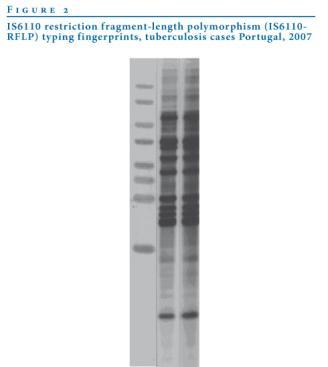 Genotyping MMWR Controlling TB in the US Nov. 2005 Refers to procedures to identify M.