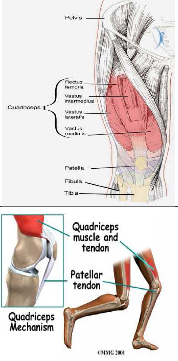 The patellar tendon is the portion of the distal tendon between the patella and the tibia. This tendon can become inflamed or degenerative.