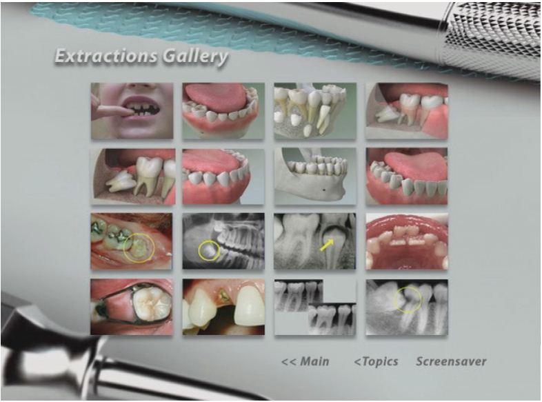 Using Image Galleries CAESY Perspective Users Guide CAESY Perspective includes a collection of silent images that you can use to accompany your own explanations of dental topics.