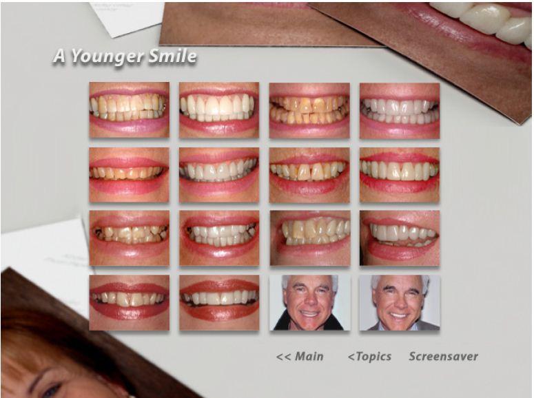 Esthetic Dentistry Images: The Esthetic Dentistry topic has a separate Before & After Galleries menu. Select an esthetic category to view esthetic dentistry solutions. 4.