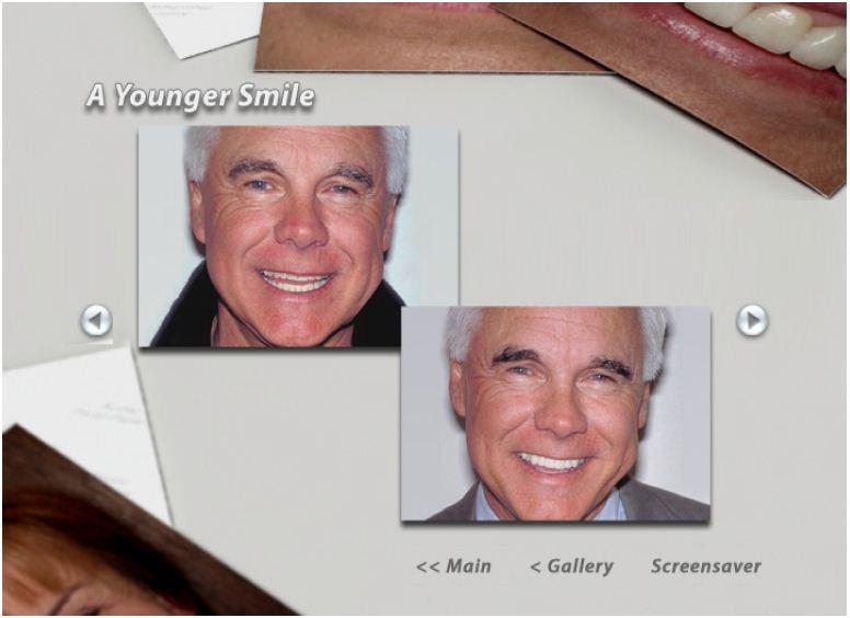 Esthetic Dentistry Before & After Galleries: In the Esthetic Dentistry topic menu, you can select a before image; select the right arrow to view an