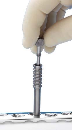 Screw Placement Verification 5. Screw placement verification Instruments 292.656 2.0 mm Non-Threaded Guide Wire 323.021 Direct Measuring Device 323.046 2.