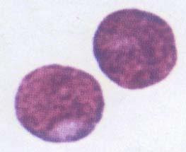 Hematopoietic Stem Cells (HSC), CD34 is the marker of HSCs.