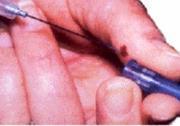 Other Work Safety Practices Contaminated Needles and Sharps Needle sticks are the most common way for infections with BBPs to occur