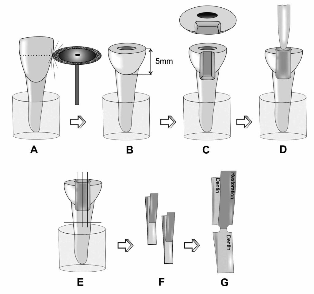 242 Operative Dentistry Figure 1. Tooth sectioning with a double-faced diamond disc (A), 5.0 mm above the CEJ (B); Class II slot preparations concluded, 1.