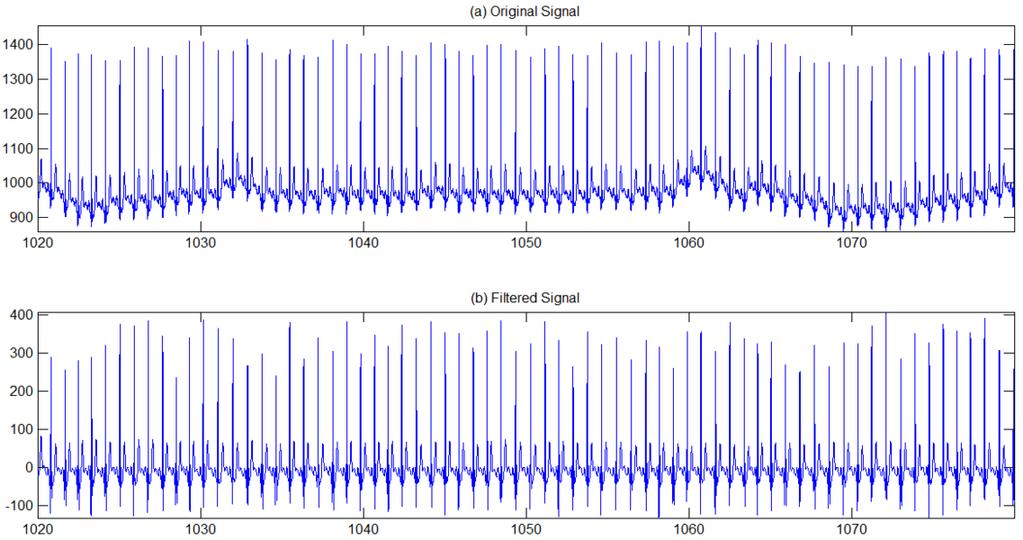 Thus the filter information contained in ca8, cd1, cd2, and cd3 eliminate the baseline drift and noise interference. The filtered result is shown in Figure 3. Fig. 2.