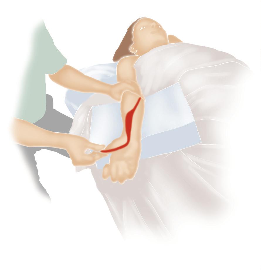 5 Palpation of the right flexor pollicis longus. 6 STRETCHING Because the flexor pollicis longus flexes the elbow, wrist, and thumb joints, it is stretched by extending the elbow, wrist, and thumb.