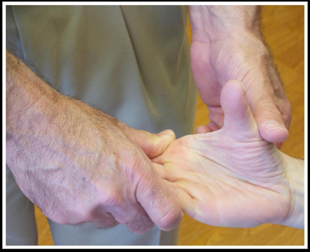Patient places the hand parallel to the floor and points the thumb