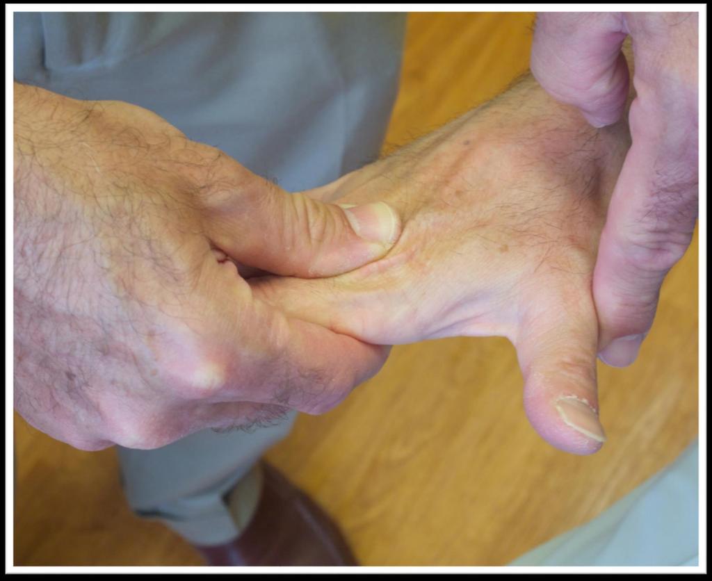Patient extends the thumb while Examiner stabilizes the 2 nd