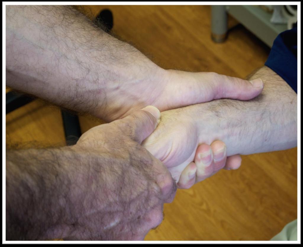 Tests C6 Wrist Flexion Patient supinates