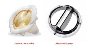 Anticoagulation for Mechanical Valves Mechanical bi-leaflet (newer) aortic valve: Warfarin INR target 2.