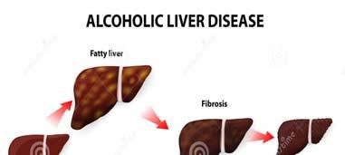 Physiological effects Gastrointestinal: liver cirrhosis, pancreatitis, gastritis, peptic ulcer,