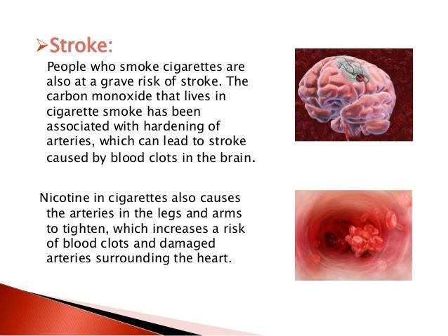 #10 Explain the effects of smoking on the Heart and Arteries: It decreases the HDL s and increases the LDL s which increases the atherosclerosis.