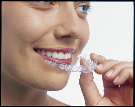 Invisalign is the clear way to straighten your teeth.