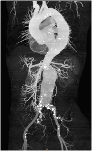 Case report A 69-year-old