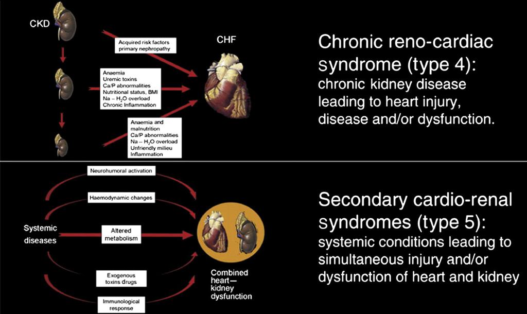 Fig. 1. Subtypes of cardiorenal syndrome. (From Ronco C, McCullough P, Anker SD, et al.
