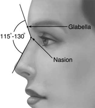 Connects the brow with the nasal dorsum Glabella Nasion Nasion Nasal tip Nasion (deepest point) should lie at supratarsal crease Angle is usually 115-130 degrees No well established