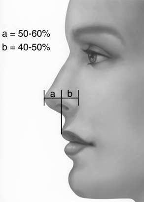 Nasal tip projection may also be measured in relation to the upper lip 50-60% of the horizontal projection of the nose lies anterior to upper lip >60% is over
