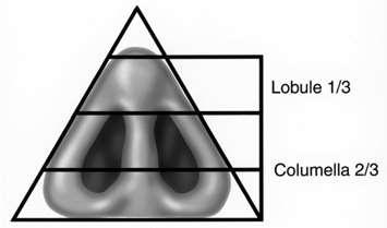 Isosceles Triangle Lobule 1/3 Columella 2/3 Nostrils