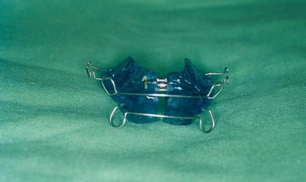 or normal vertical dimension mandibular and maxillary appliance: acrylic baseplate with