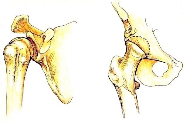Sternoclavicular Scapulothoracic Glenohumeral Minimally