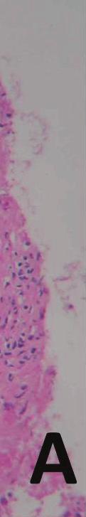 (73-83 HU) of liver parenchyma