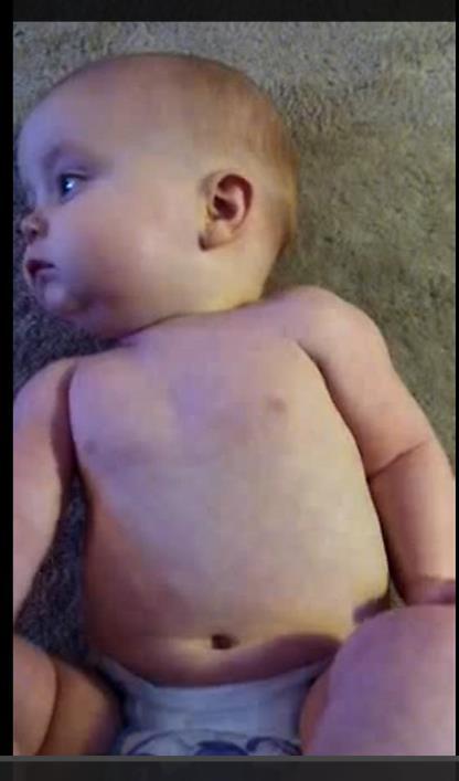 Brandon is 6 months old. Mum brings him in with cough, coryza, What are key history points?