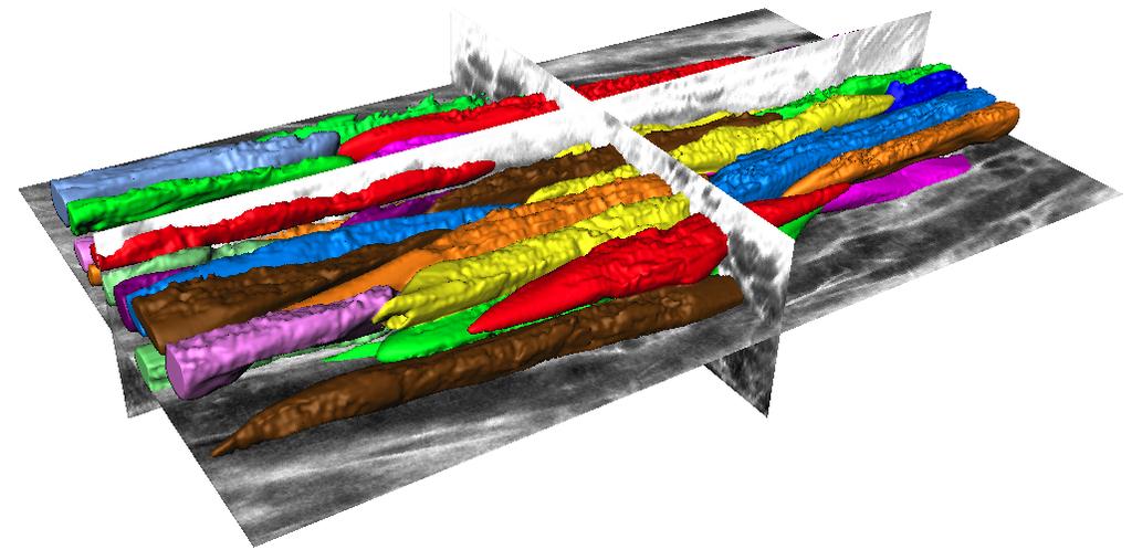 Imaging-Based 3D Model of Cardiac Tissue (Lasher et al, IEEE Trans Med