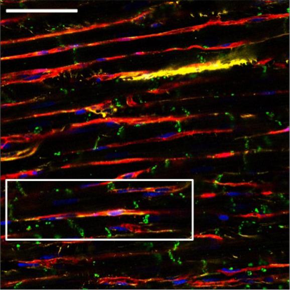 Fibroblasts in Normal Rat Ventricular Tissue 50 µm WGA Extracellular space DAPI Nuclei Cx43 Vimentin -